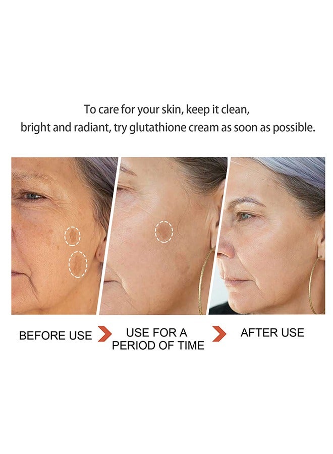 Glutathione White Cream, Kojic Acid Brighting Dark Spots Acne Scars Intensively Hydrating Soothing Cream 50g