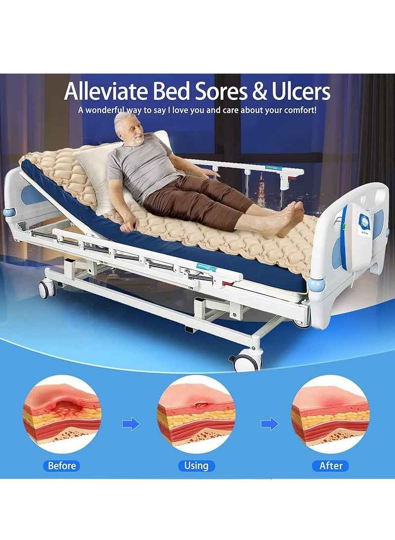 Silent Alternating Air Pressure Mattress With Mattress Cover And Pump Inflatable Silent Mattress To Prevent Bedsores And Sore Treatment For Bedridden Patients