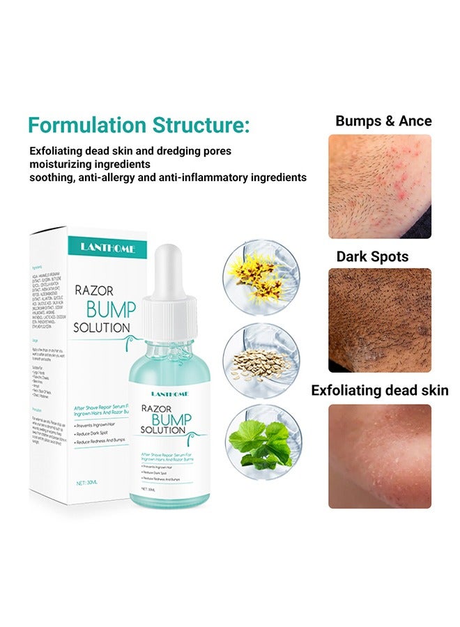 Razor Bump Solution,Hair Growth Inhibitor Safe and Gentle Repair serum, Delay Hair Growth, No Black Spots 30ml