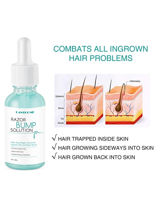 Razor Bump Solution,Hair Growth Inhibitor Safe and Gentle Repair serum, Delay Hair Growth, No Black Spots 30ml