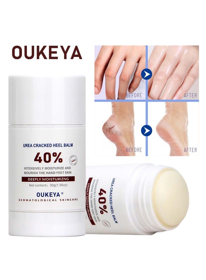 40% Urea Cracked Heel Balm, for Dry Cracked Heels Best Callus Remover For Feet & Hands Natural Moisturizes Nourishes Softens Dry Rough Cracked Dead Skin Hand and Feet Repair Balm 30g