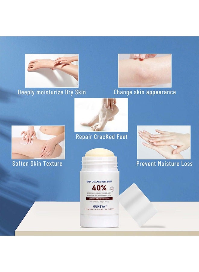 40% Urea Cracked Heel Balm, for Dry Cracked Heels Best Callus Remover For Feet & Hands Natural Moisturizes Nourishes Softens Dry Rough Cracked Dead Skin Hand and Feet Repair Balm 30g