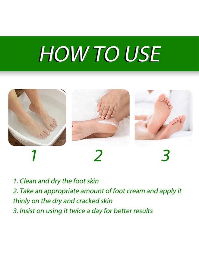 Foot Care Cream Allantoin 40% Cream For Cracked,Rough Thick and Dry Skin Soothes and Softens Feet,Elbows and Knees Hydrating and Moisturizing Foot Care Cream 100g