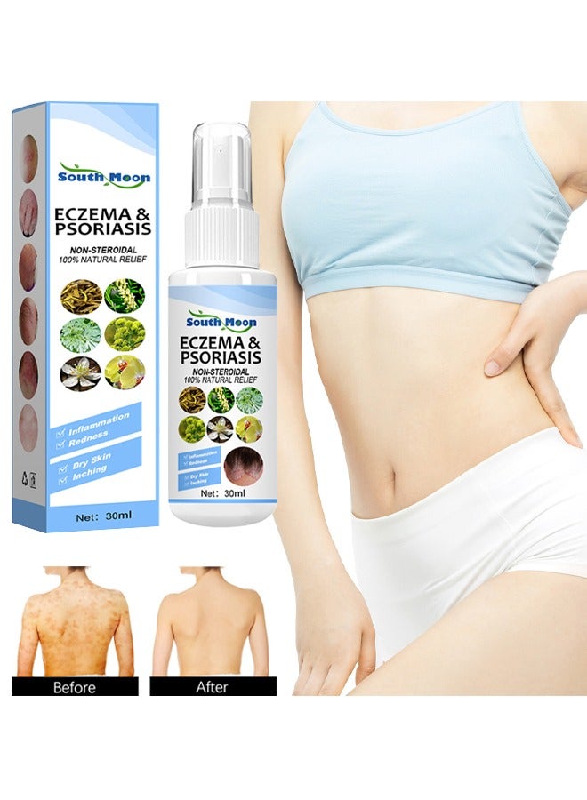 Eczema & Psoriasis Non-Steroidal100% Natural Relief，Dermatitis And Eczema Pruritus Psoriasis Spray, Say Goodbye To Scaly Skin, Eczema Relief Spray, Stops Burning And Itching 30ML