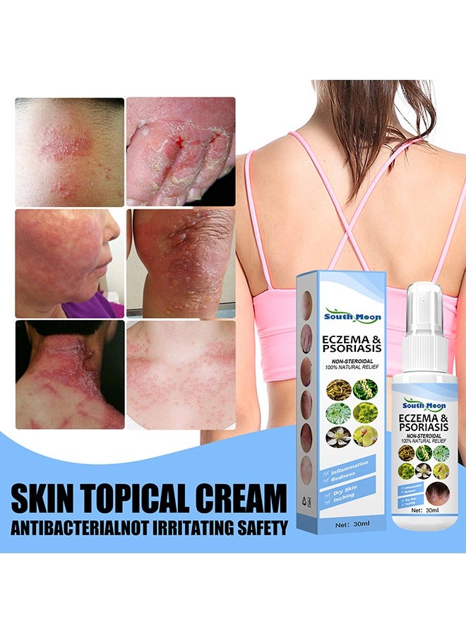 Eczema & Psoriasis Non-Steroidal100% Natural Relief，Dermatitis And Eczema Pruritus Psoriasis Spray, Say Goodbye To Scaly Skin, Eczema Relief Spray, Stops Burning And Itching 30ML