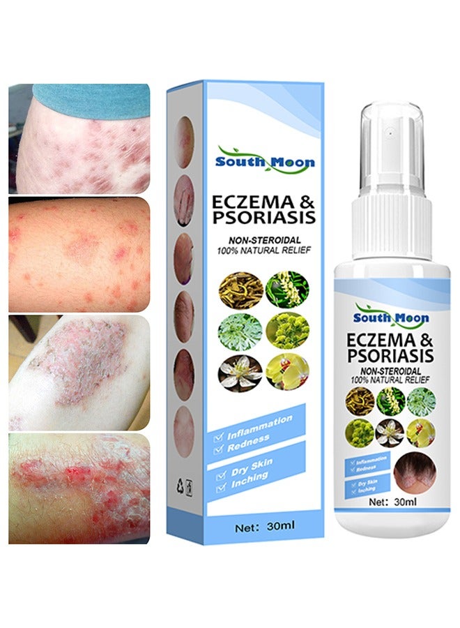 Eczema & Psoriasis Non-Steroidal100% Natural Relief，Dermatitis And Eczema Pruritus Psoriasis Spray, Say Goodbye To Scaly Skin, Eczema Relief Spray, Stops Burning And Itching 30ML