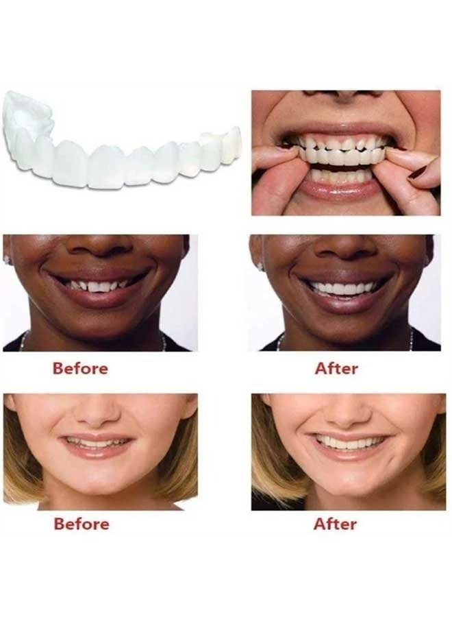 Upper and Lower Teeth Simulation Braces Snap on Smile Second Generation Simulation Braces Silicone Whitening Dentures Upper and Lower Teeth