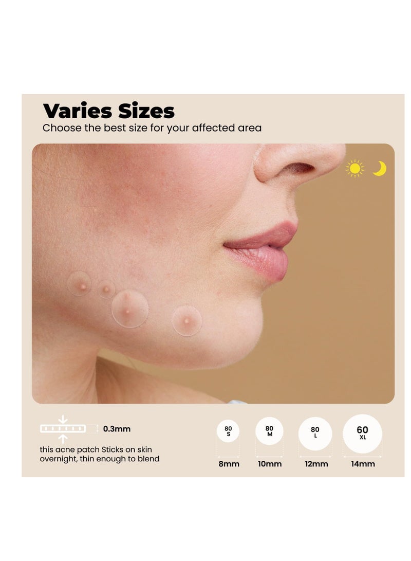ROSELYNBOUTIQUE Pimples Patches for Face - 300 Counts 4 Sizes Hydrocolloid Acne Patches Fast Absorb