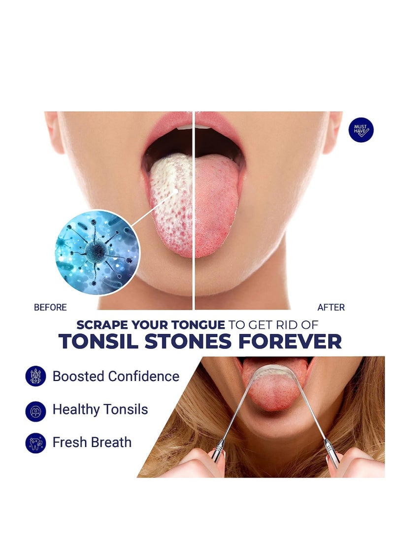 ORAVIX Tonsil Stone Remover - Tonsil Stone Removal Kit - Tonsillolith Remover Tool - Tonsil Cleaner - Fight Bad Breath - Tonsil Stone Removal Tool - Oral Irrigator - Tongue Scraper - 7 Pieces