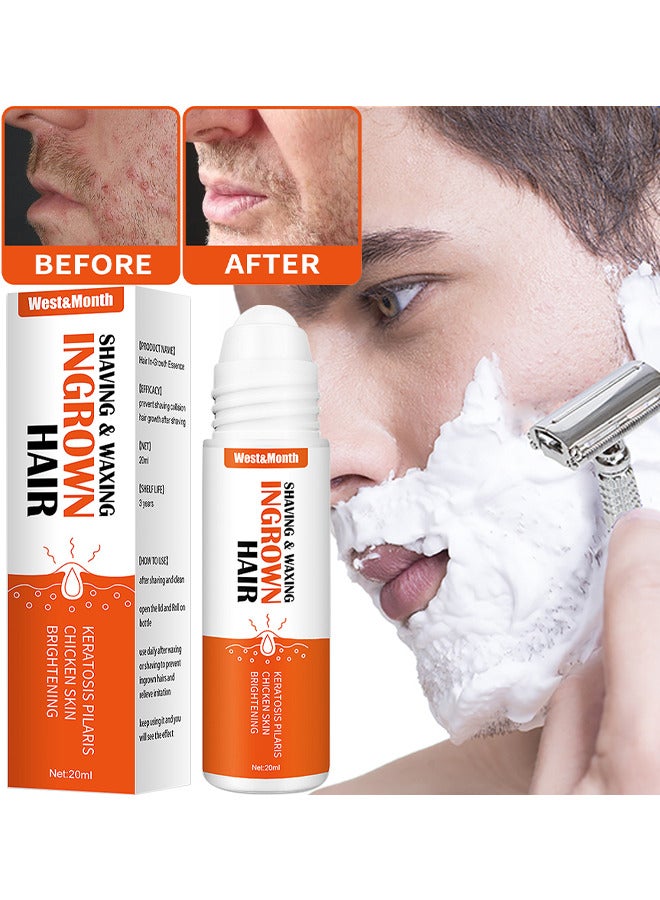 Ingrown Hair Essence Brightening Skin Get Rid Of Beard Nursing Essential Oils, Repairing Serum To Reduce Dark Spots After Shaving Gentle On Ingrown Hair