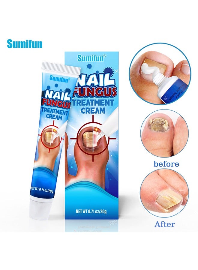 Nail Fungus Treatment Cream, Bad Nail Care Ointment, Nail Fungus Treatment, Nail Growth and Repair, Nail Treatment Repair Cream  20g