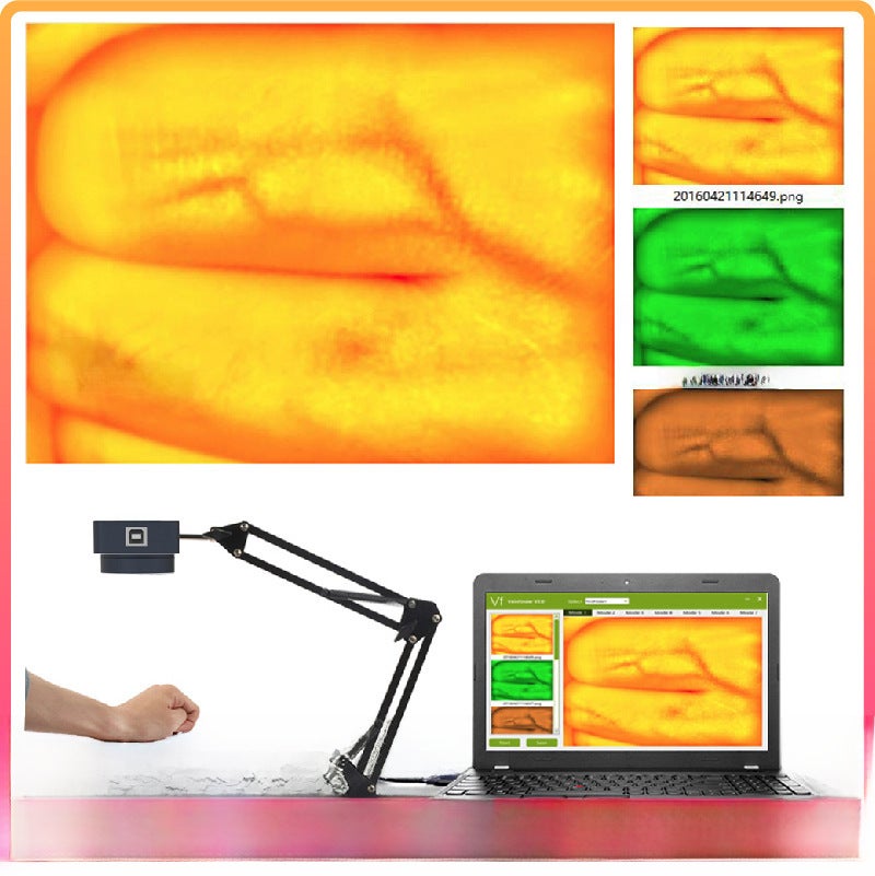 ZY600 Vein Finder Imaging Device for Phlebotomy