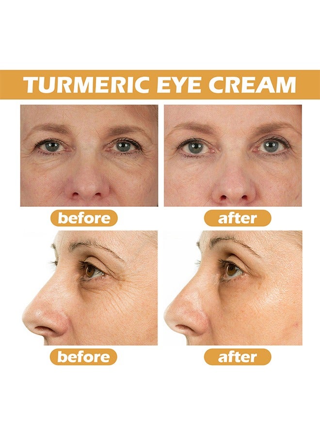 Turmeric Eye Cream-24 Hours Vanish Fine Lines，Eye Bags,Dark Circles And Puffiness