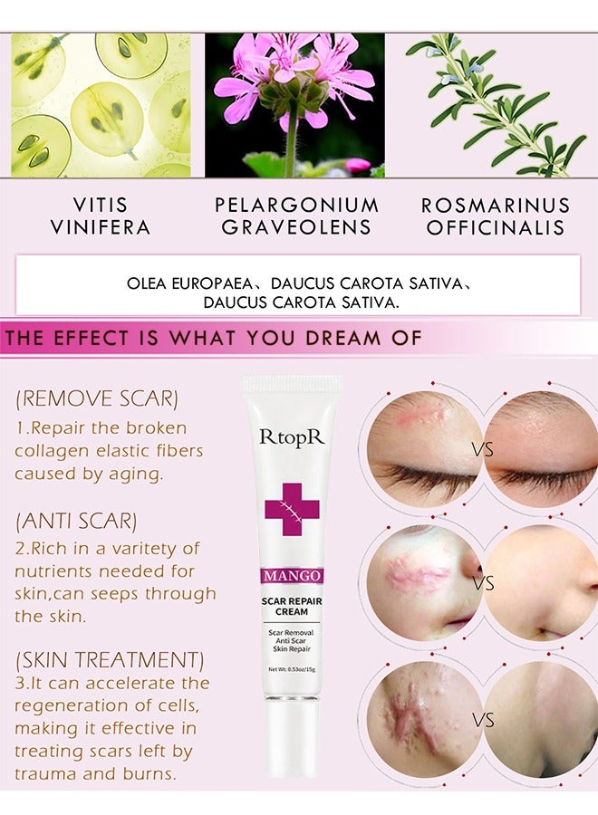 Scar Repair Cream-Skin Repair Creams Treatment Stretch Marks Acne Surgical Care 15g