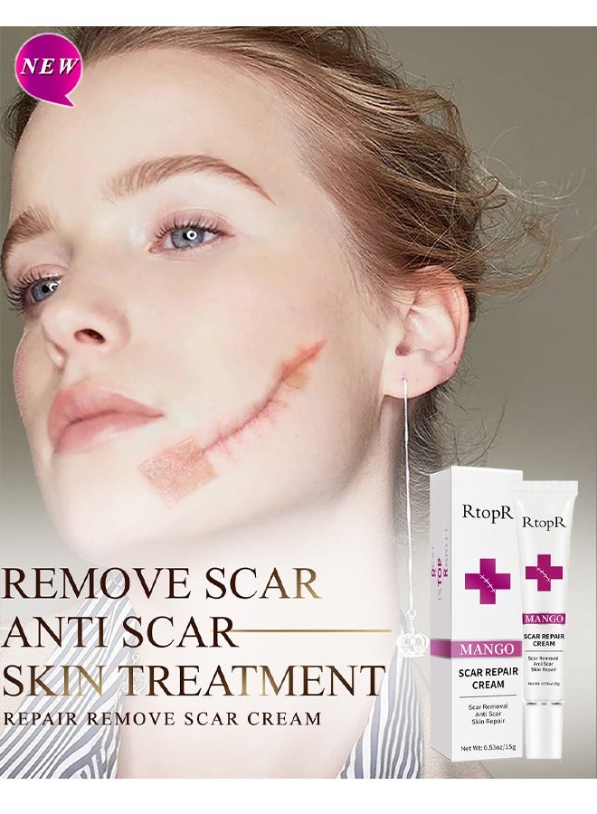 Scar Repair Cream-Skin Repair Creams Treatment Stretch Marks Acne Surgical Care 15g