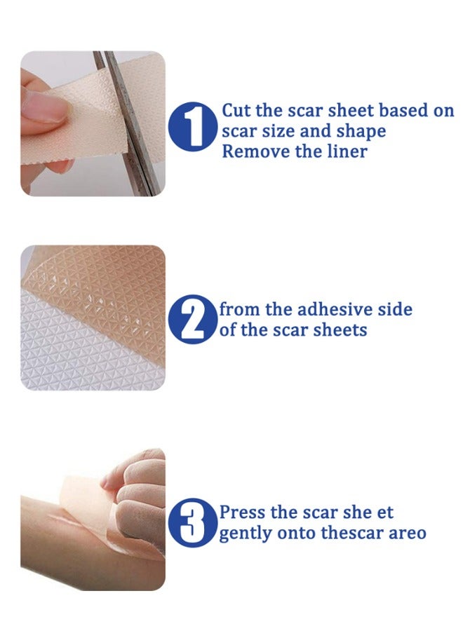 8PCS Professional Silicone Scar Sheets,Soft Silicone Gel Scar Tape Painless Silicone Tape Roll Effective Silicone Scar Removal Strips Sheets for C-Section & Keloid Surgery, Burn, Acne