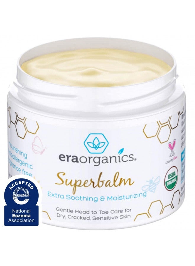 Era Organics Healing Ointment For Babies - Usda Certified Organic Natural Gentle Moisturizer For Sensitive Skin Prone To Baby Eczema, Cradle Cap (Infant Seborrheic Dermatitis), Rashes, Hives And More