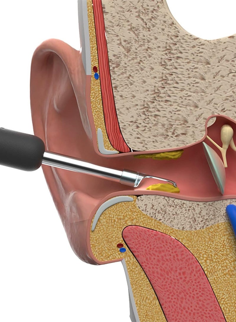 BEBIRD R1 Wireless Smart Optical Ear Cleaner Tool