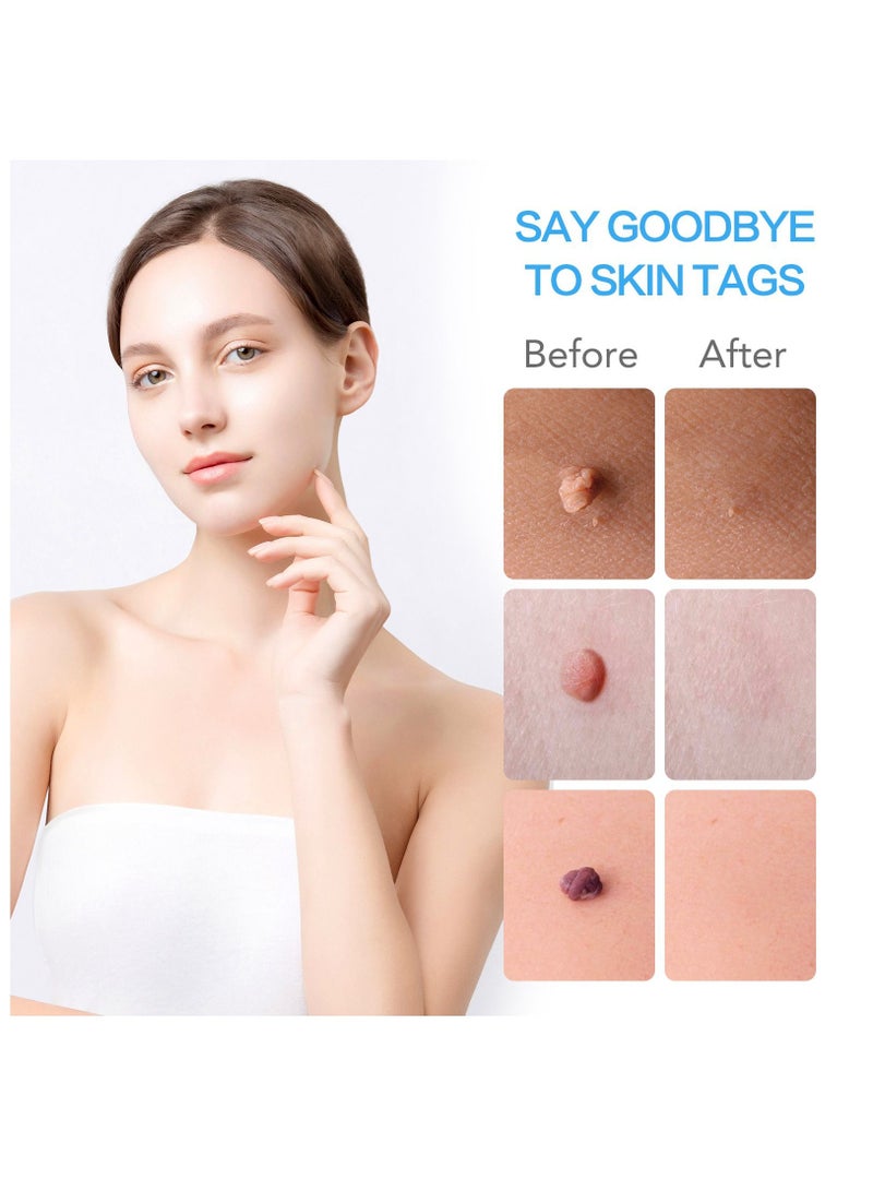 2 in 1 Skin Tag Removal Fast and Easy Skin Tag Remover Kit for Small to Large (1mm - 9mm) Tags for All Body Parts Easy to Use Safe and Painless