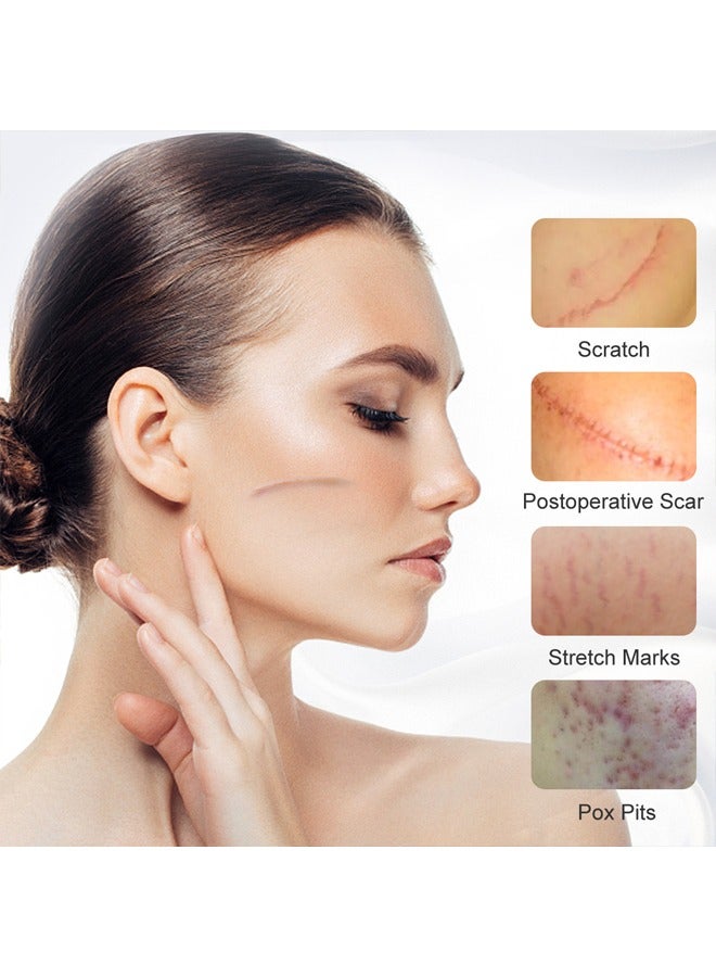 Mango Scar Removal Cream-Scar Skin Repair Treatment Stretch Marks Acne Surgical Care 15g