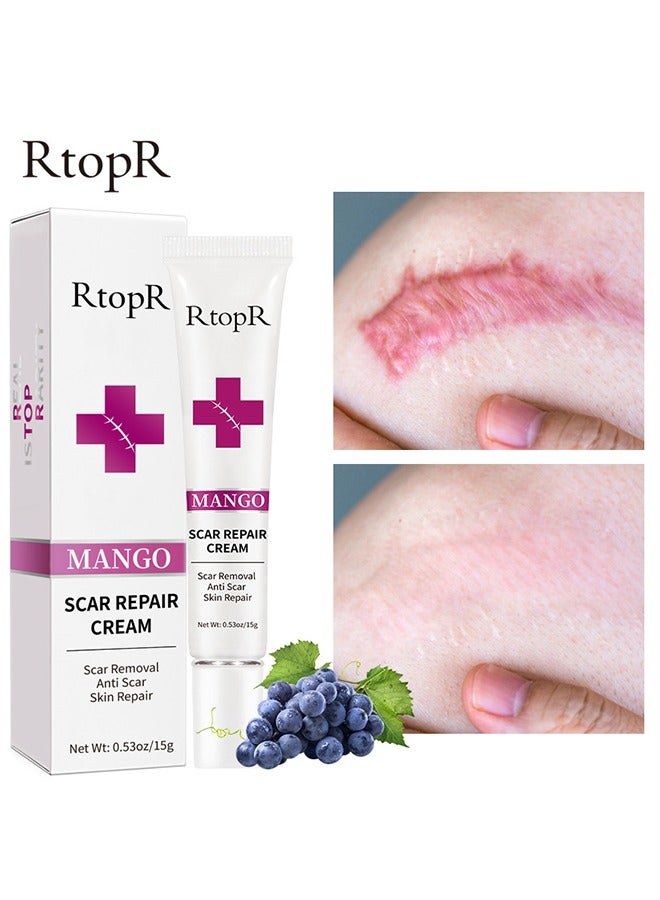 Mango Scar Removal Cream-Scar Skin Repair Treatment Stretch Marks Acne Surgical Care 15g