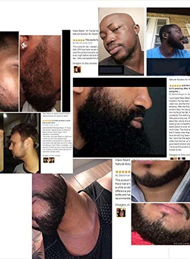 #1 Beard Growth Solution, Natural Solution for Maximum Beard Volume-2 Month Supply