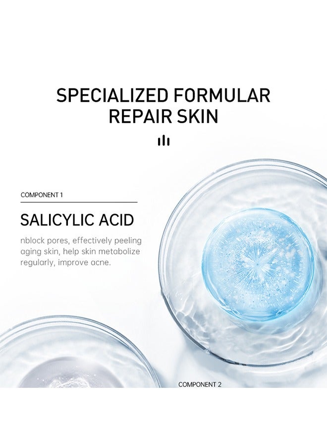 Salicylic Acid Acne Treatment Cream - Whitening Facial Treatment Hyaluronic Acid Black Dots Remove Skin Care Beauty Health 15ml