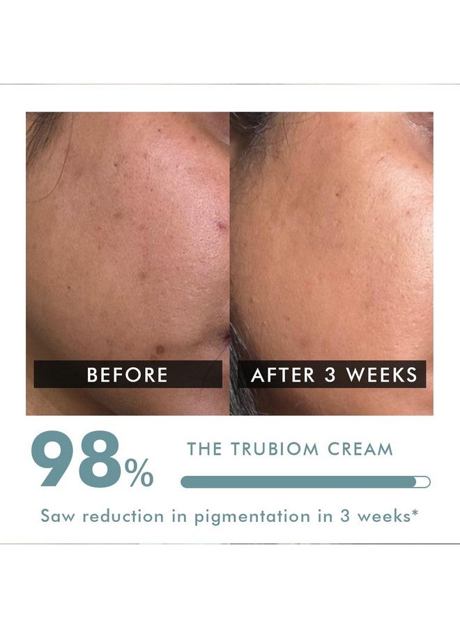 ® Pigmentation Removal Cream | 50G | Kojic Acid Cream, Azelaic Acid Cream, Tranexamic Acid & Niacinamide, Anti-Pigmentation, Reduce Dark Spots, Gel Cream, All Skin Types - Trubiom