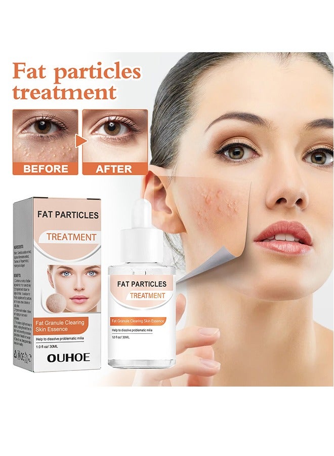 Fat Particles Treatment-Fat Granule Clearing Skin Essense，Fat Granules Removal Eye Serum, Natural Formula Milia Remover Milia Spot Treatment, Anti Dark Circle Fade Fine Essence, Anti Puffiness Moisturizing Skin Care Serum