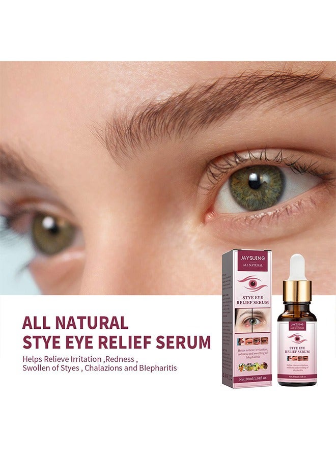 Stye Eye Relief Serum 30ml, Stye Eye Treatment, Eye Stye Remover, Chalazion Remover, Stye Eye Relief Serum for Styes Chalazion and Blepharitis Treatment, Eye Care, Mild Lash and Eye Cleanser