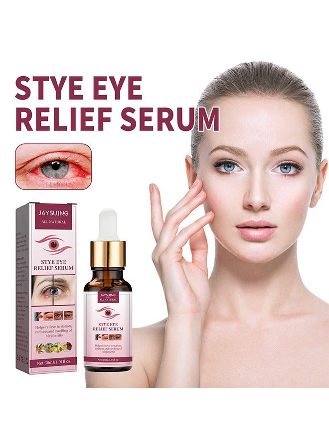 Stye Eye Relief Serum 30ml, Stye Eye Treatment, Eye Stye Remover, Chalazion Remover, Stye Eye Relief Serum for Styes Chalazion and Blepharitis Treatment, Eye Care, Mild Lash and Eye Cleanser