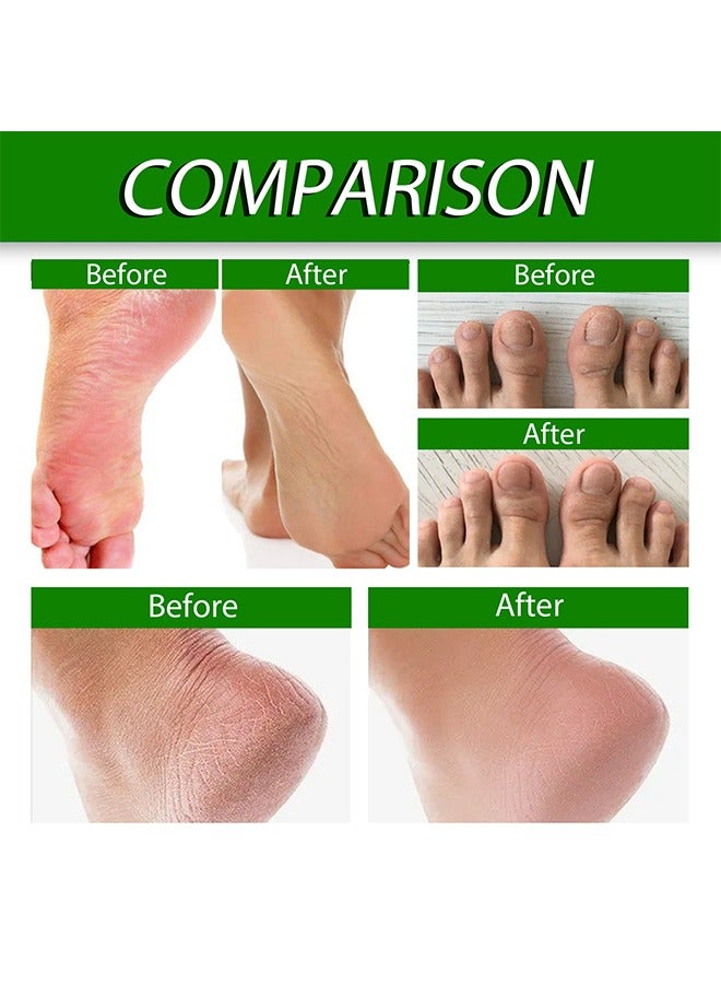 Allantoin 40% Cream- Foot Care Cream  For Cracked,Rough Thick and Dry Skin Soothes and Softens Feet,Elbows and Knees Hydrating and Moisturizing Foot Care Cream