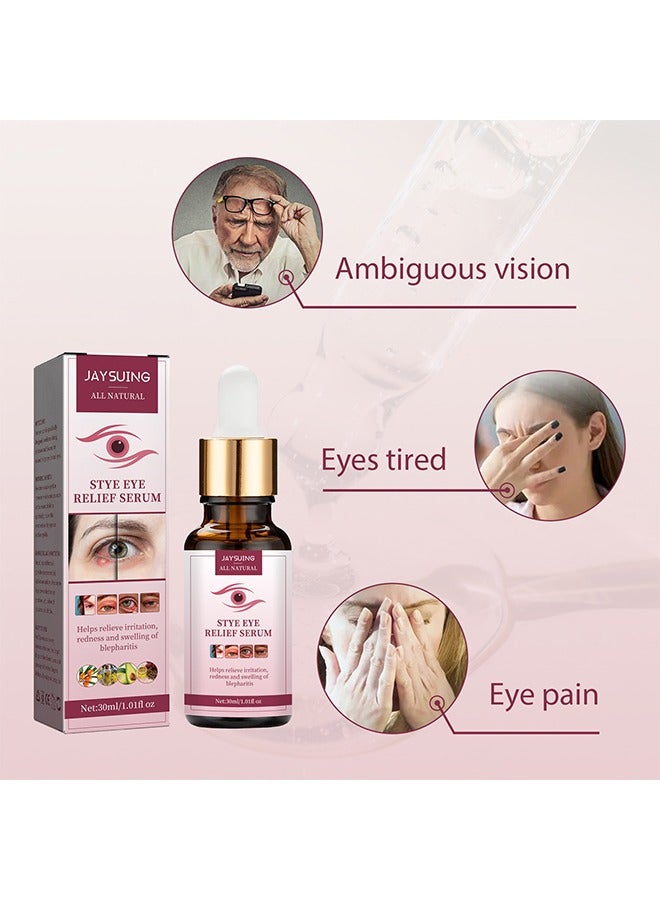 Stye Eye Relief Serum, Stye Eye Treatment, Eye Stye Remover, Chalazion Remover, Stye Eye Relief Serum for Styes Chalazion and Blepharitis Treatment, Eye Care, Mild Lash and Eye Cleanser 30ml