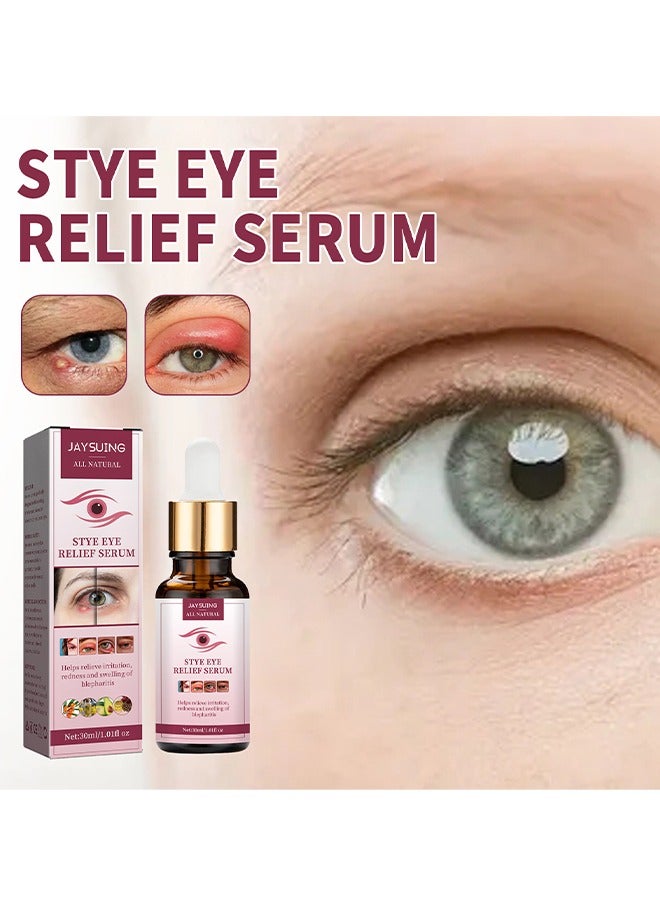 Stye Eye Relief Serum, Stye Eye Treatment, Eye Stye Remover, Chalazion Remover, Stye Eye Relief Serum for Styes Chalazion and Blepharitis Treatment, Eye Care, Mild Lash and Eye Cleanser 30ml