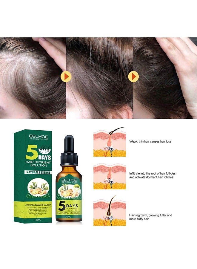 Hair Nutrient Solution, for Hair Fall Hair Regrowth And Scalp, Treatment Ginger Essential Oil Supports Healthy Hair Thinning Treatment Hair Growth Oil for Men 30ML