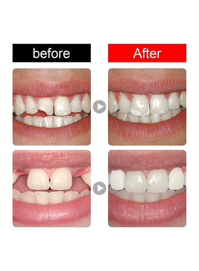 Moldable False Teeth, Reusable/Temporary Molded/Denture Replacement, Used To Fill Missing Broken Teeth, Quickly Restore Confident Smile, Tooth Filling Repair Kit