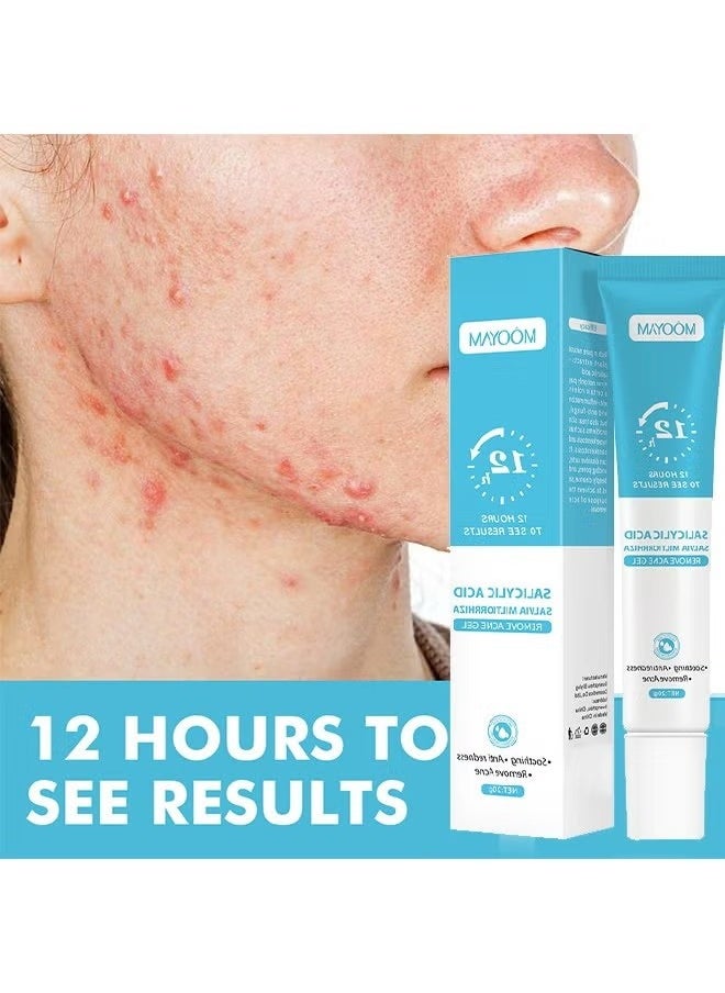 Salicylic Acid Remove Acne Gel-Rapid Action Acne Spot Treatment for Face Closure & Acne Dots, Premium Acne Scar Gel & Pimple Remover 20g