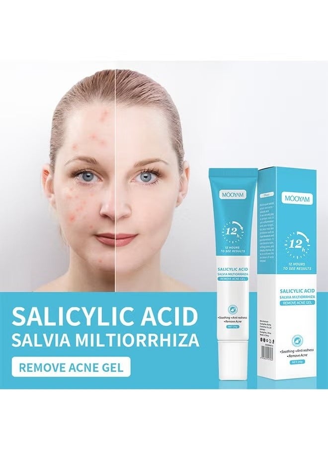 Salicylic Acid Remove Acne Gel-Rapid Action Acne Spot Treatment for Face Closure & Acne Dots, Premium Acne Scar Gel & Pimple Remover 20g