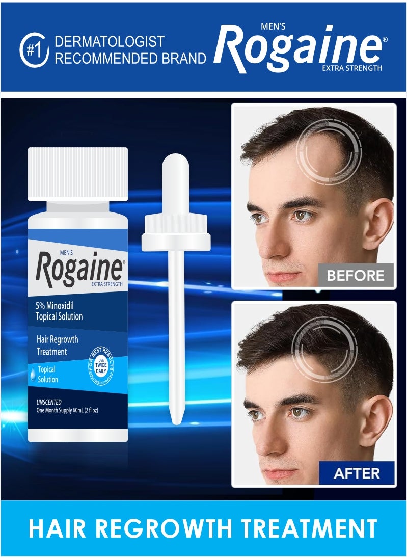 Rogaine Men's Extra Strength 60 ML – Hair Regrowth Treatment for Thinning Hair