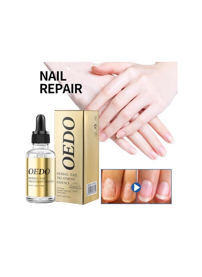 Oedo Herbal Nail Treatment Essence,Rosabelle Nail Kit,Oedo Herbal Nail Essence,Herbal Nourishing Fingernail,Oedo Nail Treatment Oil,For Weak and Damaged Nails (2PCS)