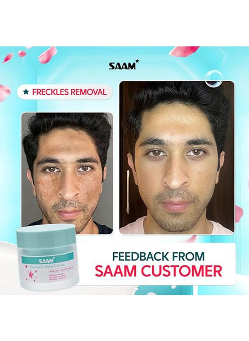 SAAM Renewal Face Cream | Melasma, Freckles, Age Spots & Dark Spots | With Alpha Arbutin and Kojic Acid | 50g