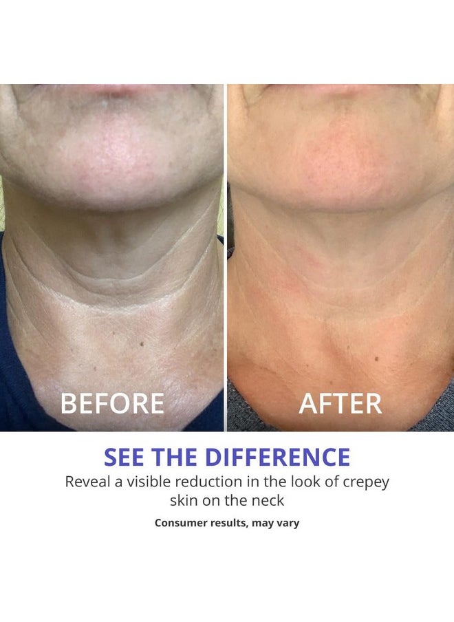 Neck Firming Cream - Anti-Aging Neck Cream For Tightening And Wrinkles For An Even Skin Tone And Neck Lift - With Pro-Active Firming Complex, 1.7 Oz