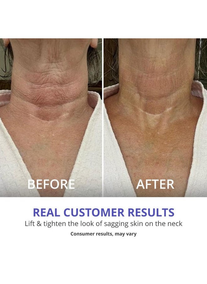 Neck Firming Cream - Anti-Aging Neck Cream For Tightening And Wrinkles For An Even Skin Tone And Neck Lift - With Pro-Active Firming Complex, 1.7 Oz