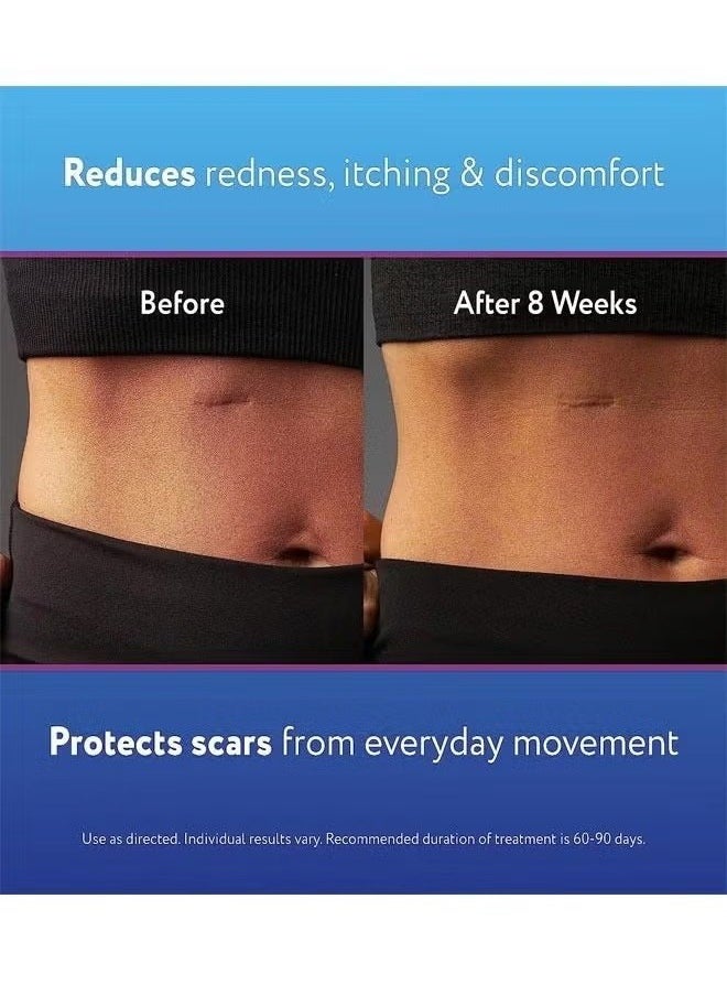 Sinclair Gel for Scars 15g, Reduces the Appearance of Old New Scars, Stretch Marks, Surgery, Injuries, Burns and Acne