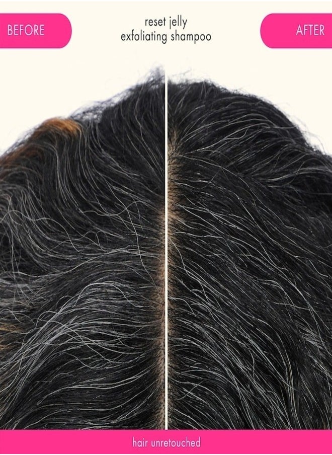 AMIKA Reset Exfoliating Jelly Scalp Scrub 140ml - Clarifying and Detoxifying Scalp Scrub for Clean, Healthy Hair Growth