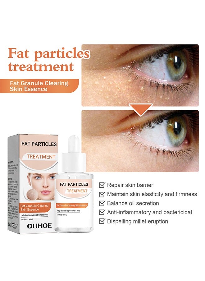 Fat Particles Treatment-Fat Granule Clearing Skin Essense，Fat Granules Removal Eye Serum, Natural Formula Milia Remover Milia Spot Treatment, Anti Dark Circle Fade Fine Essence, Anti Puffiness Moisturizing Skin Care Serum