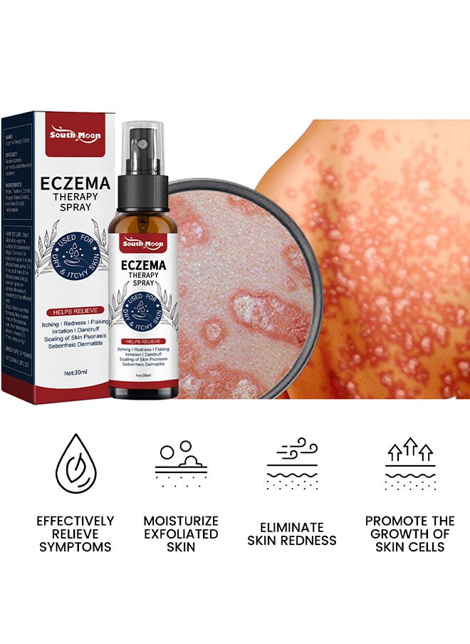 Psoriasis Relief Spray 30ML, All Natural Eczema Treatment, Psoriasis Treatment, Fast Relieve Itching And Redness, Skin Care Pain Itch Therapy Spray, Fast Relief Spray For Face And Body