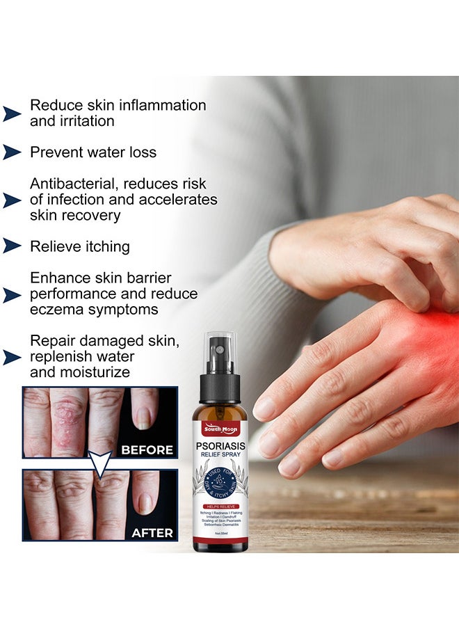 Psoriasis Relief Spray 30ML, All Natural Eczema Treatment, Psoriasis Treatment, Fast Relieve Itching And Redness, Skin Care Pain Itch Therapy Spray, Fast Relief Spray For Face And Body