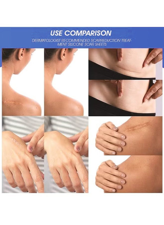 Scar Removal Cream, Skin Repairing Cream Fade Scars And Stretch MarksAnd Acne Treatment, Improve Scar Skin, Deeply Moisturizes Skin, For Surgical Scars Stretch Marks Acne Old Or New Scars