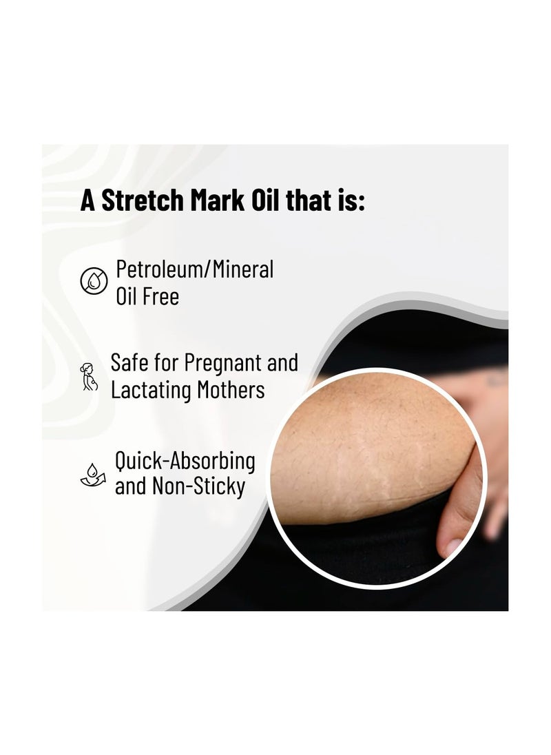 Chemist at Play Stretch Mark & Scar Fading Oil Enriched with 10 Natural Oils Like Almond, Rosemary, Rosehip Oils & More, Vitamin C & E | Scar Removal & Reduce Stretch Marks | All Skin Types | 50ml